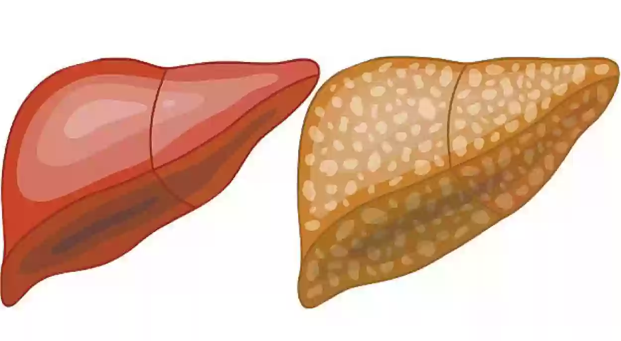 بعد انتشار الأخبار حول تسبب الكركم في تليف الكبد